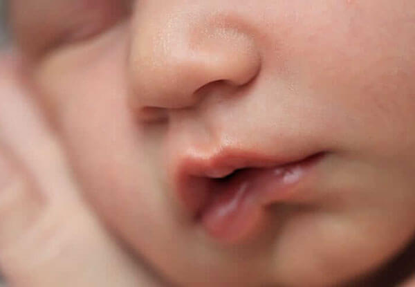 image of a baby's mouth